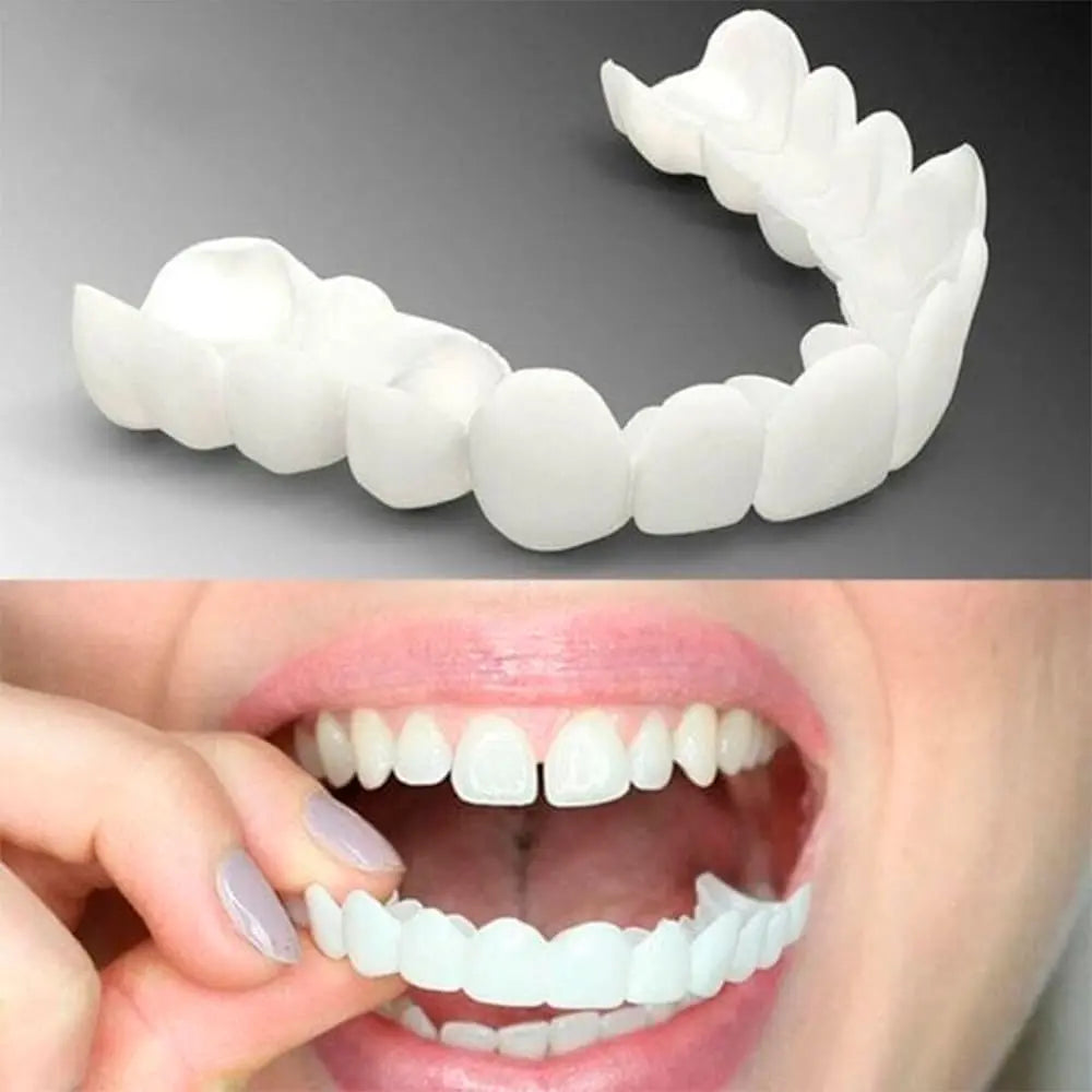 Kit 2 Lente Dental White - Snap On Smile - Sorriso Perfeito com Conforto e Praticidade