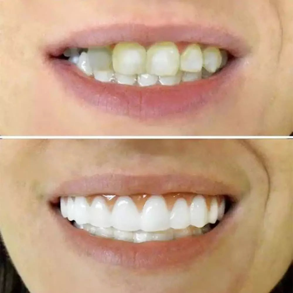 Kit 3 Dentadura NewSmile - Tenha o Sorriso Dos Seus Sonhos